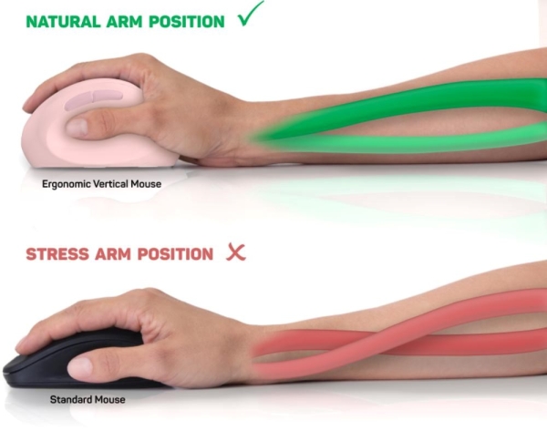 CONNECT IT FOR HEALTH LADIES PINK Bezdrátová vertikální myš, ergonomická, růžová